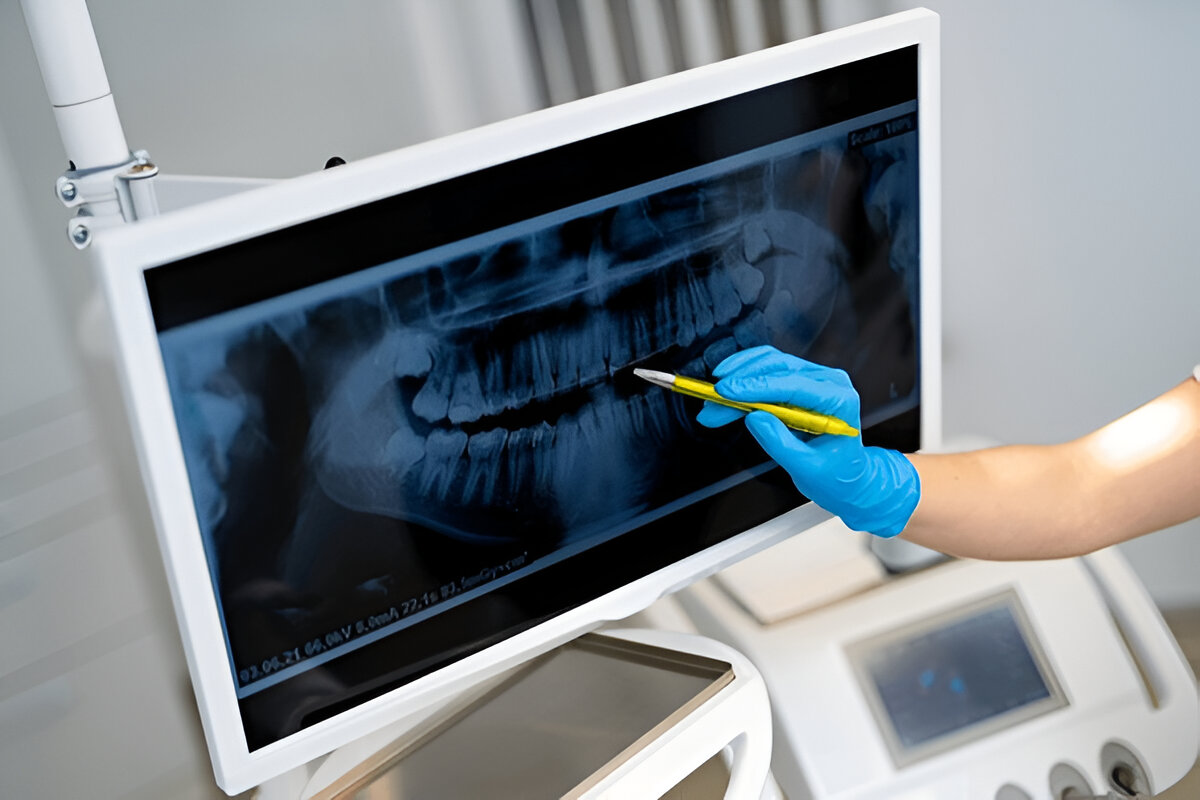 Cirugía Maxilofacial 02