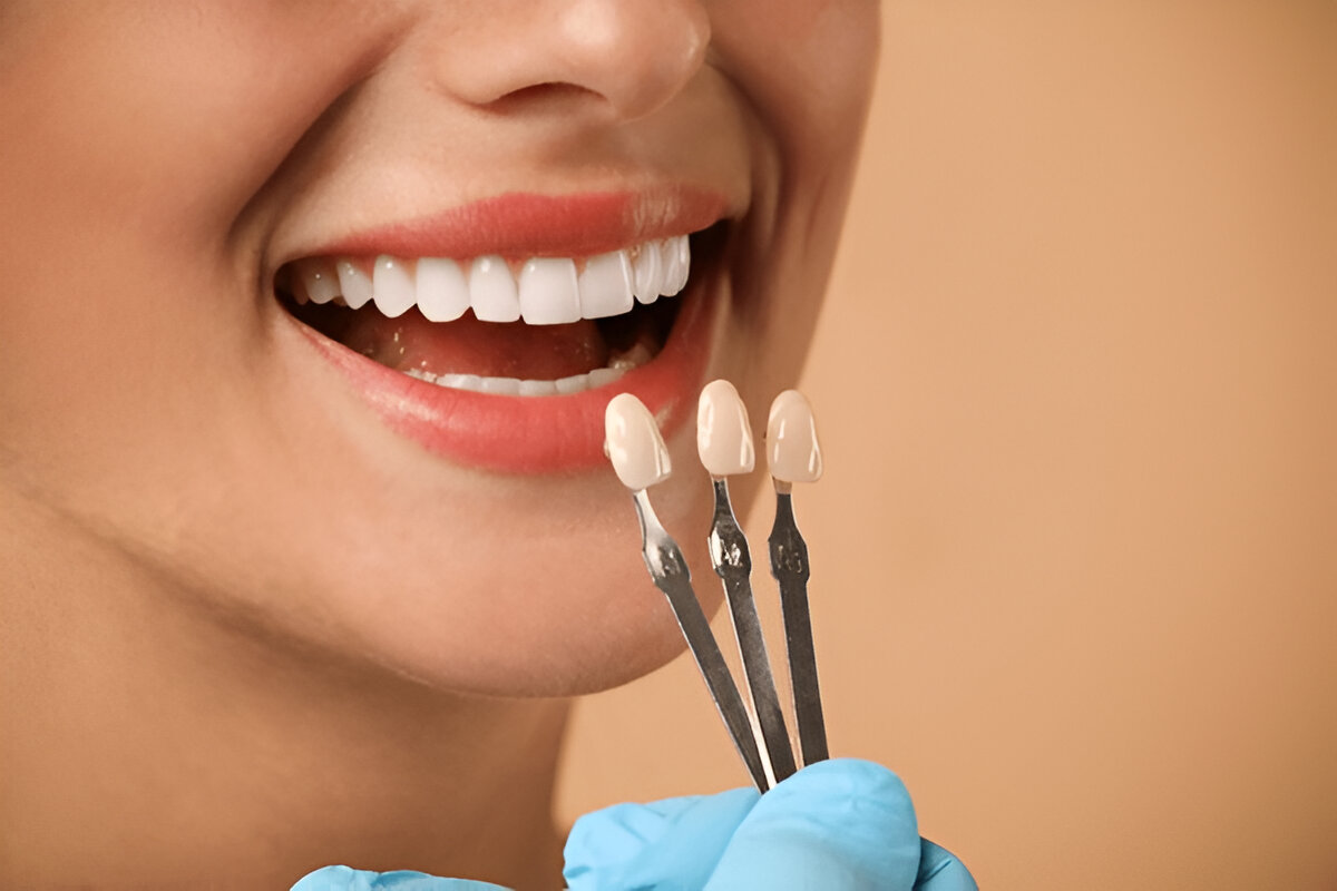 Estética Dental Consultorio Odontológico en Lima